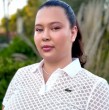 Michelle Carvalho se sometió a una serie de tratamientos de nácar para disminuir las manchas faciales y darle nuevo brillo a su rostro.