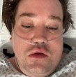 Nicolás Yunge preocupó a sus seguidores tras revelar que se encuentra hospitalizado en la Unidad de Cuidados Intensivos (UCI), luego de someterse a un procedimiento dental.