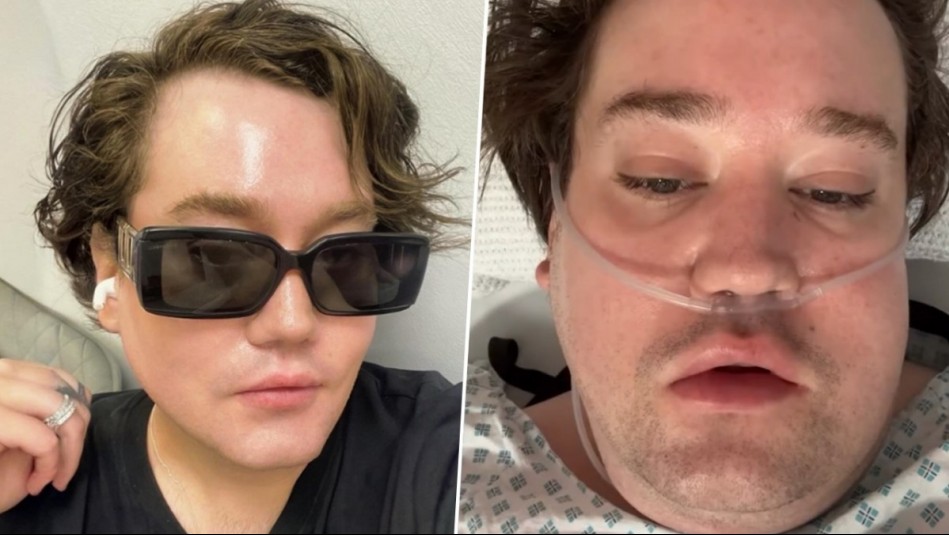 'Estoy contento con la vida que tuve': Nicolás Yunge preocupa a seguidores tras ser hospitalizado en la UCI