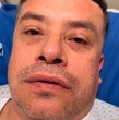 El cantante nacional Leandro Martínez dio a conocer una preocupante situación que vivió en su cara, hecho que lo llevó hasta urgencias.