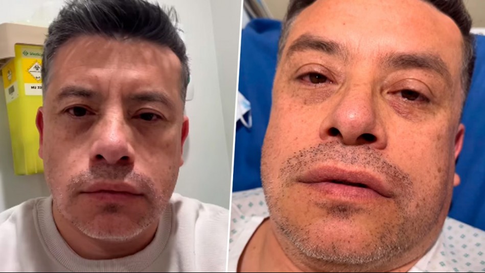 'Pensé que me moriría': Leandro Martínez relata inesperada emergencia médica que lo dejó en urgencias