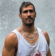 Pero Astorga se valió de una curiosa imagen editada digitalmente para aclarar por qué tuvo que someterse a una operación