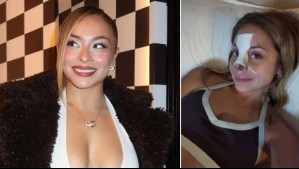 Skarleth Labra muestra su transformación tras cirugía en la nariz: 'Quería un cambio muy armonioso'