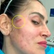 Adriana Barrientos volvió a captar la atención en redes sociales tras compartir detalles de un procedimiento estético al que se sometió en el rostro y el cuello.