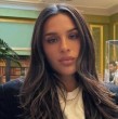 Gianella Marengo muestra las consecuencias de un accidente doméstico que sufrió.