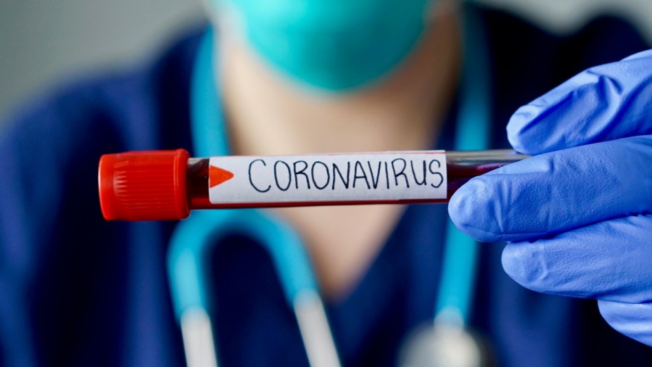 Infectólogo llama a la calma por coronavirus en Chile: Coronavirus en Chile