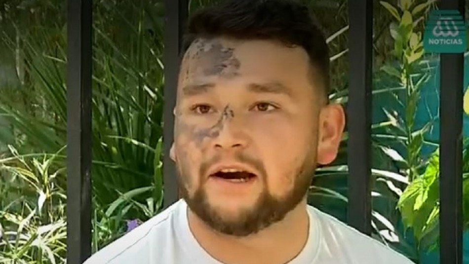 Bastián Barrios Sobreviviente de explosión e incendio en Pudahuel: