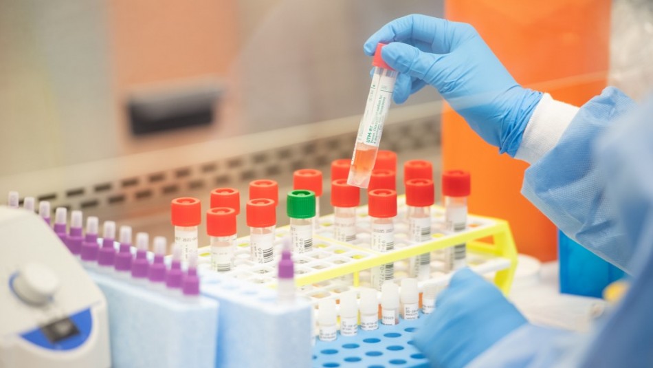 Coronavirus Minsal eleva a 33 la cifra de contagiados con coronavirus en Chile