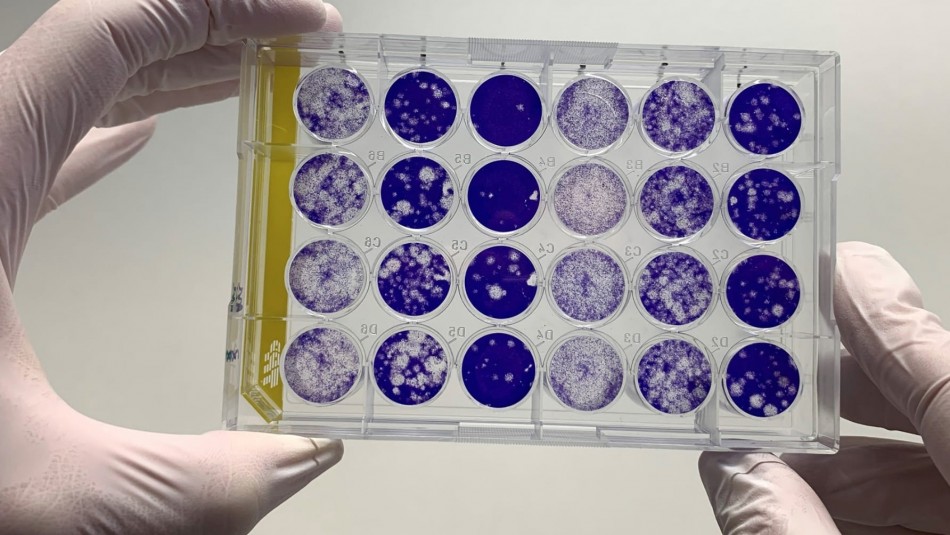 Científicos alemanes identifican en qué momento un paciente con coronavirus deja de ser contagioso Científicos alemanes identifican en qué momento un paciente con coronavirus deja de ser contagioso