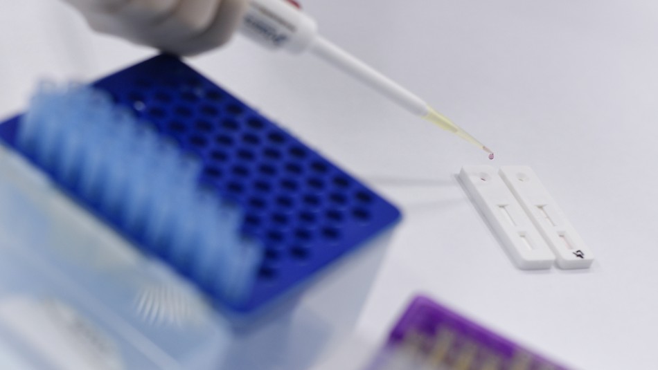 Universidad de Oxford dispondrá en septiembre de un millón de vacunas experimentales contra el coronavirus Universidad de Oxford dispondrá en septiembre de un millón de vacunas experimentales contra el coronavirus