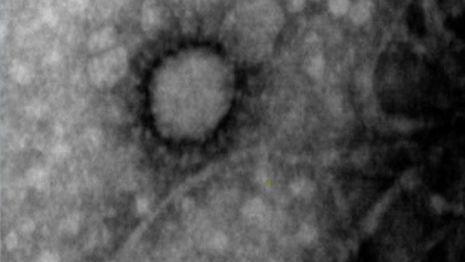 Primera foto del Covid-19 Científicos argentinos logran captar primera foto del nuevo coronavirus