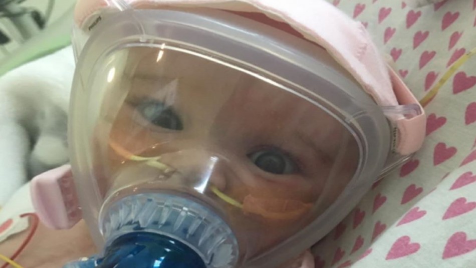 Erin Bates Bebé de 6 meses superó cirugía de corazón abierto y el Covid-19