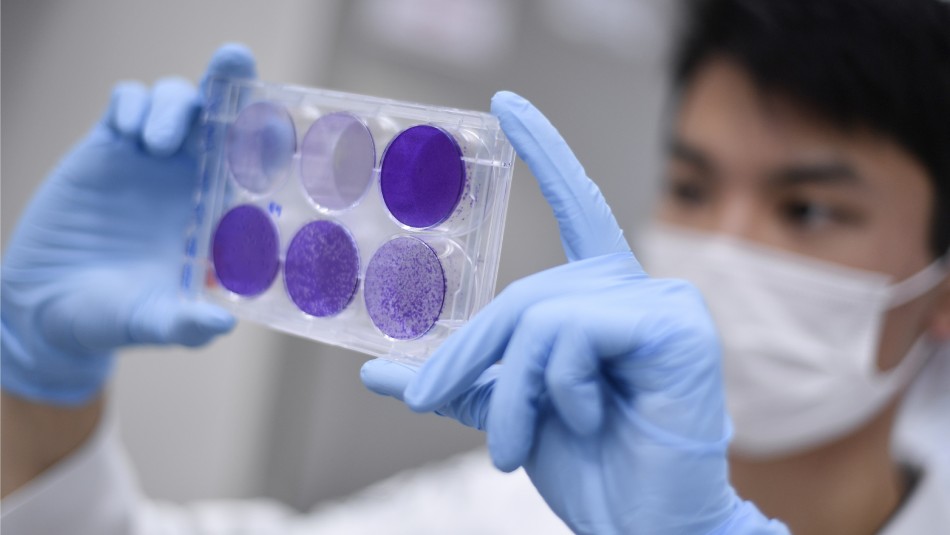 Universidad de Oxford asegura que su vacuna contra el coronavirus funcionó en monos Universidad de Oxford asegura que su vacuna contra el coronavirus funcionó en monos