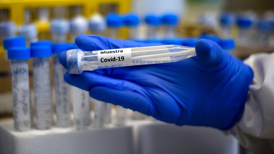 Reporte diario del Minsal por coronavirus en Chile Nuevo balance del Minsal: Reportan 43 fallecidos en solo 24 horas y más de 65 mil contagios por coronavirus