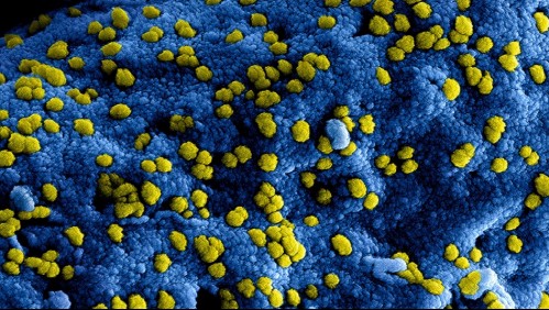 Tejido eléctrico: La solución japonesa para destruir bacterias y que puede servir contra el coronavirus