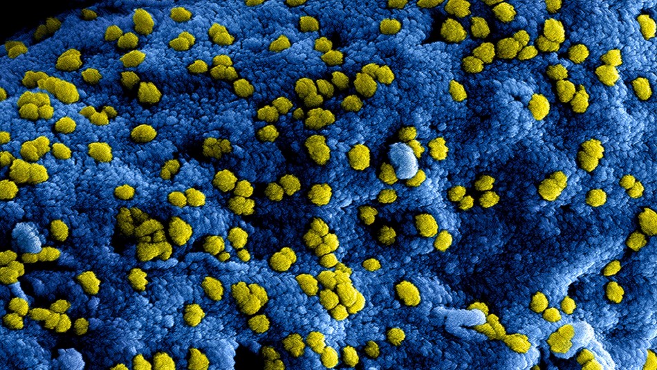 Tejido eléctrico: La solución japonesa para destruir bacterias y que puede servir contra el coronavirus Tejido eléctrico: La solución japonesa para destruir bacterias y que puede servir contra el coronavirus