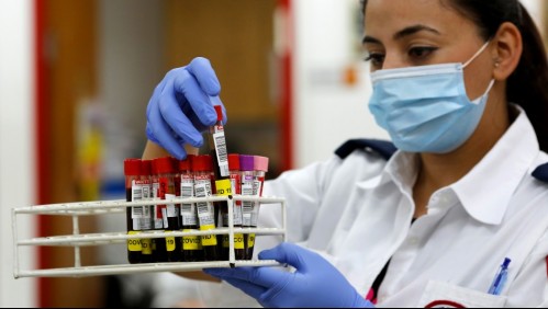 Conoce qué son los anticuerpos y cómo actúan en el organismo humano