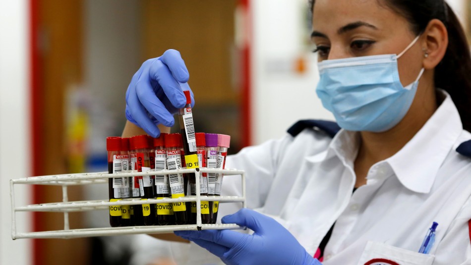 Conoce qué son los anticuerpos y cómo actúan en el organismo humano Conoce qué son los anticuerpos y cómo actúan en el organismo humano