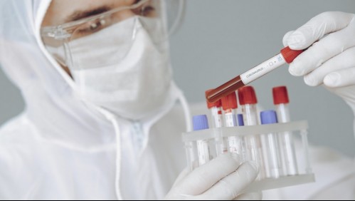 La OMS suma uso de lentes protectores para evitar el coronavirus