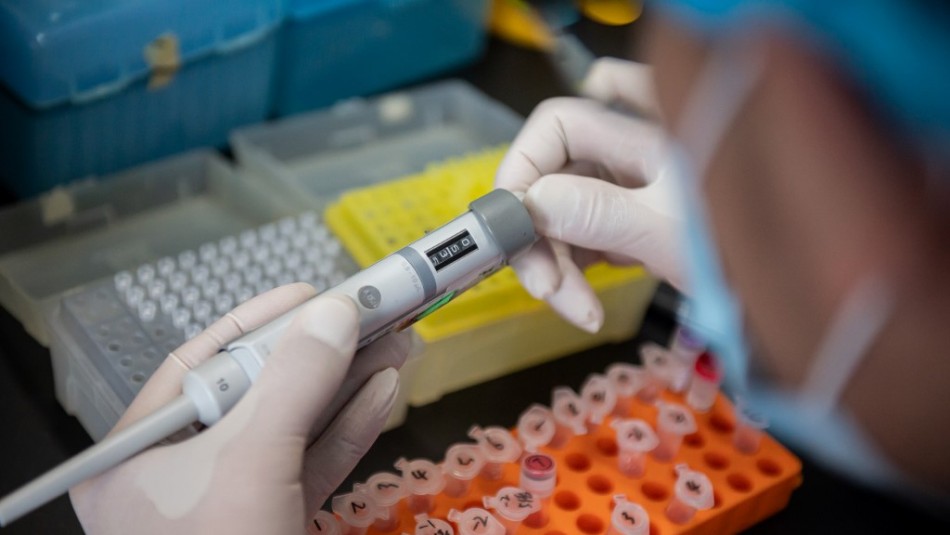 Hombres calvos tendrían mayores probabilidades de sufrir graves síntomas de coronavirus