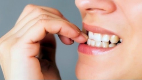 Estos son los peligros de comerte las uñas