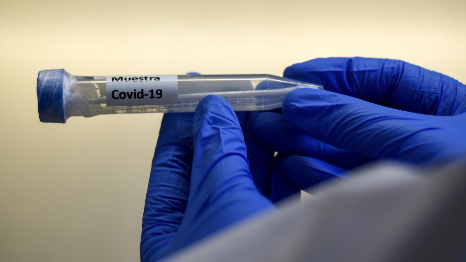 Coronavirus Epidemióloga por coronavirus: