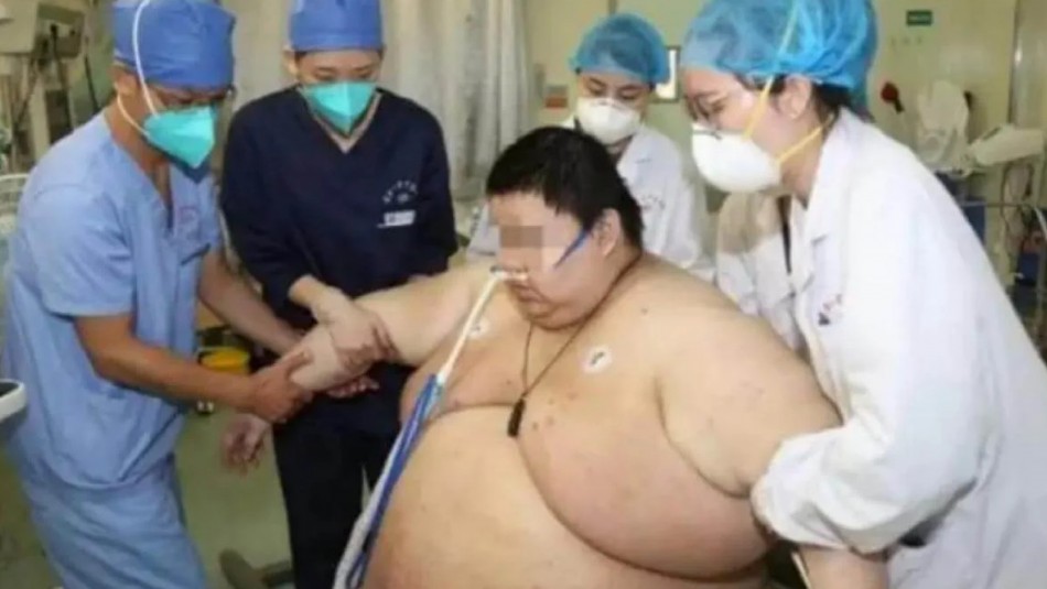 Un hombre aumentó 100 kilos tras estar cinco meses aislado en Wuhan por la cuarentena Un hombre aumentó 100 kilos tras estar cinco meses aislado en Wuhan por la cuarentena