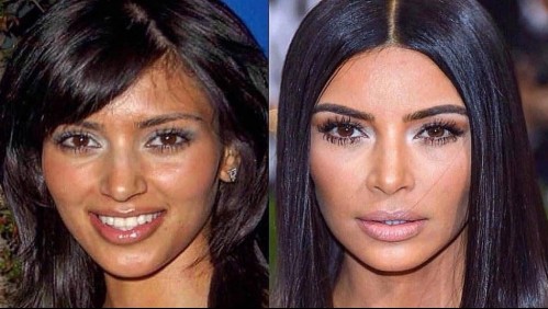 Kim Kardashian a la medida: cómo las cirugías transformaron su cuerpo y rostro