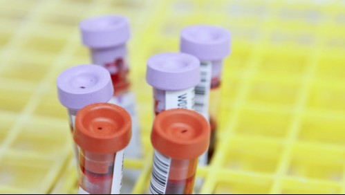 Encuentran anticoagulante que evita la falla orgánica en pacientes con coronavirus