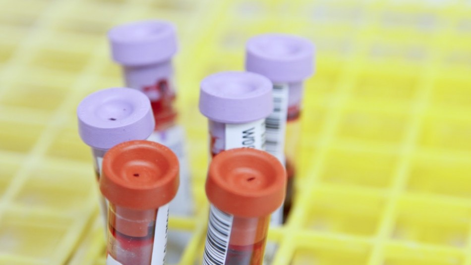 Encuentran anticoagulante que evita la falla orgánica en pacientes con coronavirus Encuentran anticoagulante que evita la falla orgánica en pacientes con coronavirus