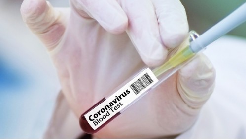 Anticuerpos contra el coronavirus podrían desaparecer entre dos a tres meses según estudio