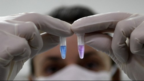 Expertos señalan que coronavirus se comporta como enfermedad de transmisión sexual