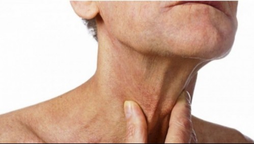 Más de la mitad de pacientes con coronavirus presentan disfagia