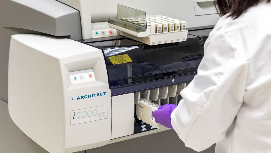 Imagen referencial Nuevo test que permite detectar anticuerpos en personas que tuvieron coronavirus llega a Chile