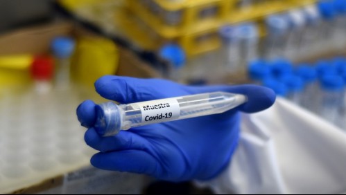 Infectólogo por 'leve mejoría': 'Puede ser una foto de un momento y no necesariamente una tendencia'