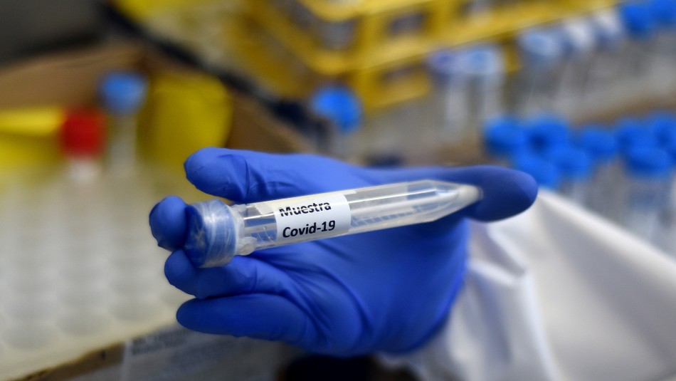 Test coronavirus Infectólogo por 'leve mejoría':