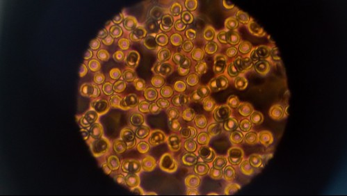 La 'transformación macabra' que sufren las células por el coronavirus