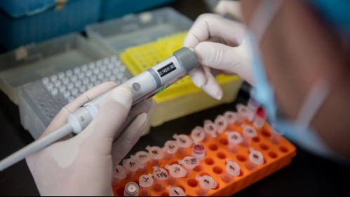 Probarán en Chile fármaco contra el coronavirus que entró en fase de ensayos clínicos