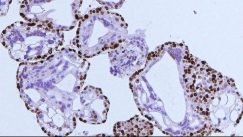 Ameba 'come cerebros' enciende alertas sanitarias en Estados Unidos