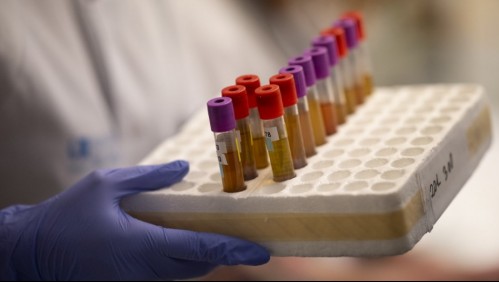 Estudio: Hidroxicloroquina no protege de cuadros graves por coronavirus a largo plazo