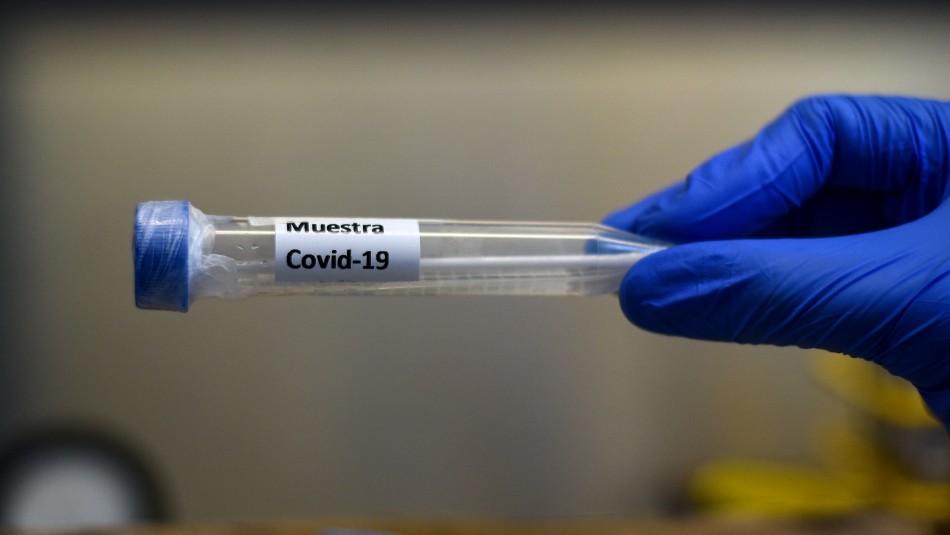 Nuevo reporte diario del Minsal por coronavirus en Chile Minsal reporta 100 nuevas muertes y más de 312.000 contagios por coronavirus en Chile