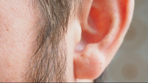 Hombre se cortó la oreja y no fue al hospital por temor a contagiarse de coronavirus: Se la cosió un veterinario