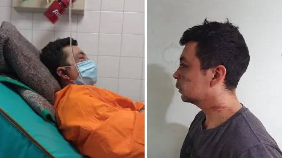 Enfermero argentino sufre golpiza de sus vecinos por haber tenido coronavirus: También le quemaron su casa Enfermero argentino sufre golpiza de sus vecinos por haber tenido coronavirus: También le quemaron su casa