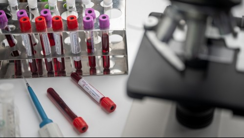 Investigador de la U. de Chile: 'Veo muy difícil que esté disponible una vacuna antes de un año'