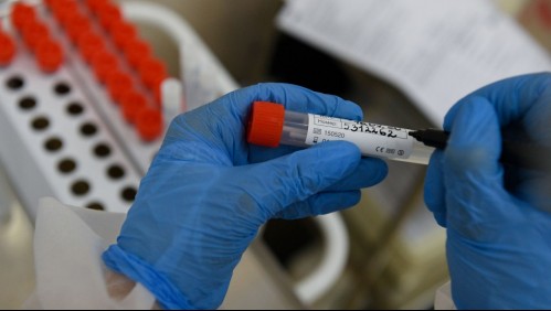 'Está lista': Rusia anuncia que su vacuna contra coronavirus superó con éxito todas las pruebas
