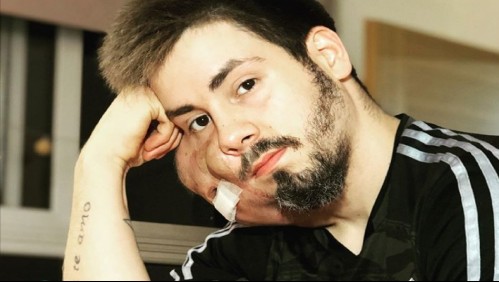 'Nunca pensé que se transformaría en esto': La historia del argentino que tiene un agresivo cáncer de cara