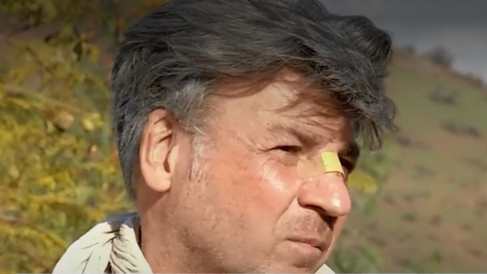 Chef Yann Yvin tras sufrir violenta encerrona y quedar herido: Chef Yann Yvin tras sufrir violenta encerrona y quedar herido: