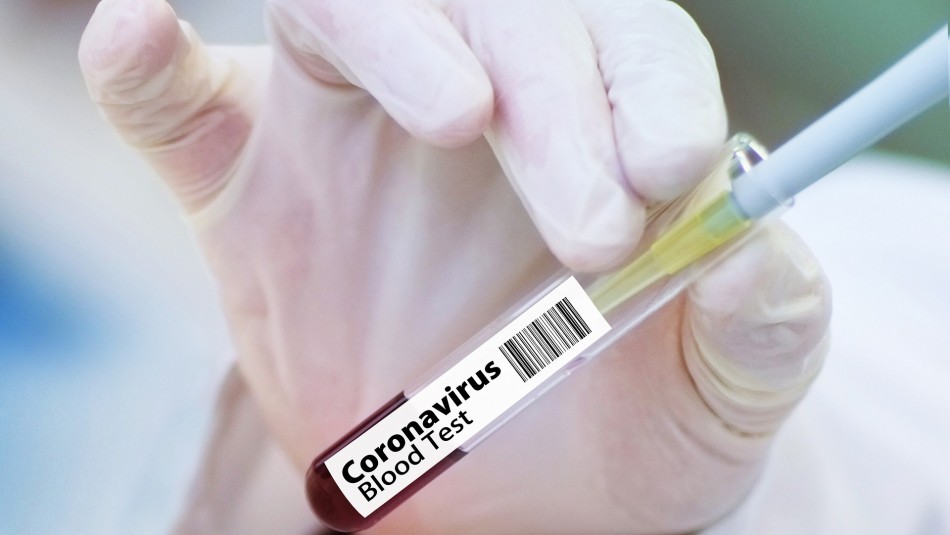 Vacuna chilena contra el coronavirus podría comenzar ensayos clínicos a finales de 2020 Vacuna chilena contra el coronavirus podría comenzar ensayos clínicos a finales de 2020