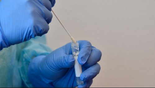 Científicos chilenos desarrollan método para diagnosticar coronavirus sin PCR