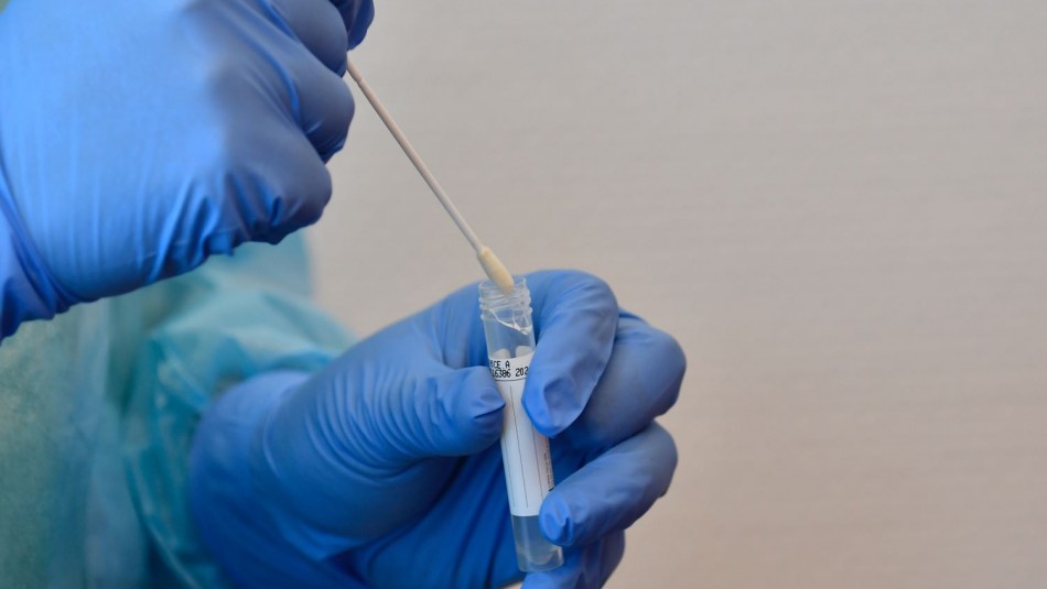 Científicos chilenos desarrollan método para diagnosticar coronavirus sin PCR Científicos chilenos desarrollan método para diagnosticar coronavirus sin PCR